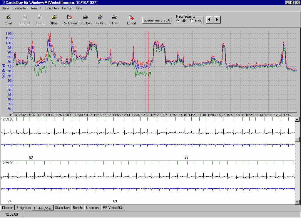 CardioDay-hf-min-maxCKCg7pbkRDceq